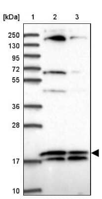 Western Blot: RPL32 Antibody [NBP2-48874] - Lane 1: Marker [kDa] 250, 130, 95, 72, 55, 36, 28, 17, 10Lane 2: Human cell line RT-4Lane 3: Human cell line U-251MG sp