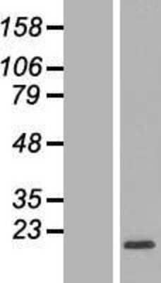 Western Blot: RPL32 Overexpression Lysate (Adult Normal) [NBP2-08837] Left-Empty vector transfected control cell lysate (HEK293 cell lysate); Right -Over-expression Lysate for RPL32.