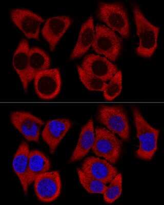 Immunocytochemistry/Immunofluorescence: RPL36 Antibody [NBP2-94161] - Confocal immunofluorescence analysis of HeLa cells using RPL36 Polyclonal Antibody (NBP2-94161) at dilution of 1:200. Blue: DAPI for nuclear staining.