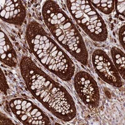 Immunohistochemistry-Paraffin: RPL36 Antibody [NBP2-13255] - Staining of human rectum shows strong cytoplasmic positivity in glandular cells.