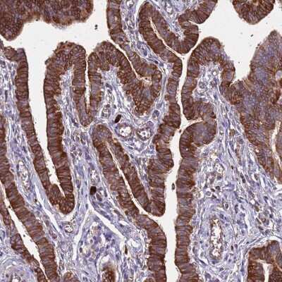 Immunohistochemistry-Paraffin: RPL36 Antibody [NBP2-13255] - Staining of human Fallopian tube shows strong cytoplasmic positivity in glandular cells.