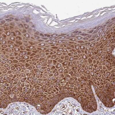 Immunohistochemistry-Paraffin: RPL36 Antibody [NBP2-13255] - Staining of human skin shows moderate cytoplasmic positivity in squamous epithelial cells.