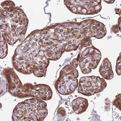 Immunohistochemistry-Paraffin: RPL36 Antibody [NBP2-13255] - Staining of human placenta shows strong cytoplasmic positivity in trophoblastic cells.