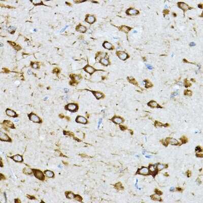 Immunohistochemistry-Paraffin: RPL36 Antibody [NBP2-94161] - Immunohistochemistry of paraffin-embedded rat brain using RPL36 Rabbit pAb (NBP2-94161) at dilution of 1:200 (40x lens). Perform high pressure antigen retrieval with 10 mM citrate buffer pH 6.0 before commencing with IHC staining protocol.