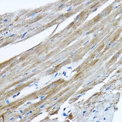 Immunohistochemistry-Paraffin: RPL36 Antibody [NBP2-94161] - Immunohistochemistry of paraffin-embedded mouse heart using RPL36 Rabbit pAb (NBP2-94161) at dilution of 1:200 (40x lens). Perform high pressure antigen retrieval with 10 mM citrate buffer pH 6.0 before commencing with IHC staining protocol.