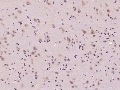 Immunohistochemistry-Paraffin: RPL36 Antibody [NBP2-97618] - Immunochemical staining of human RPL36 in human brain with rabbit polyclonal antibody at 1:100 dilution, formalin-fixed paraffin embedded sections.