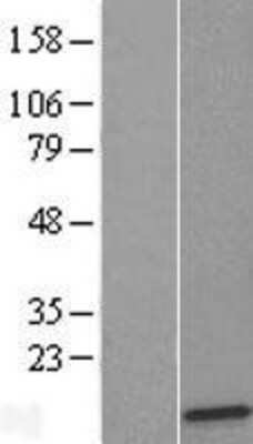 Western Blot: RPL36 Overexpression Lysate (Adult Normal) [NBP2-05867] Left-Empty vector transfected control cell lysate (HEK293 cell lysate); Right -Over-expression Lysate for RPL36.