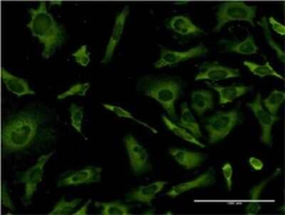 Immunocytochemistry/ Immunofluorescence RPL36A Antibody (5F8) - Azide and BSA Free