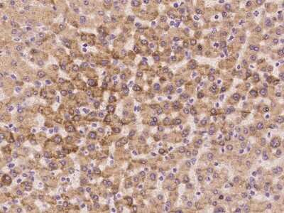 Immunohistochemistry-Paraffin: RPL37A Antibody [NBP2-97946] - Immunochemical staining of human RPL37A in human liver with rabbit polyclonal antibody at 1:100 dilution, formalin-fixed paraffin embedded sections.