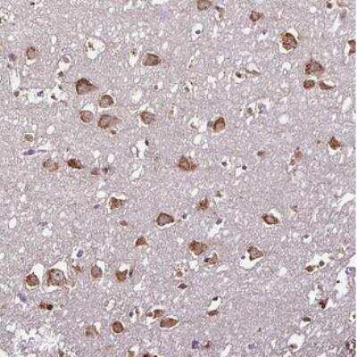 Immunohistochemistry: RPL38 Antibody [NBP2-30693] - Staining of human cerebral cortex shows strong granular cytoplasmic positivity in neuronal cells.