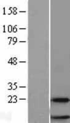 Western Blot: RPL38 Overexpression Lysate (Adult Normal) [NBL1-15535] Left-Empty vector transfected control cell lysate (HEK293 cell lysate); Right -Over-expression Lysate for RPL38.