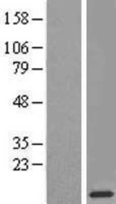 Western Blot: RPL38 Overexpression Lysate (Adult Normal) [NBL1-15536] Left-Empty vector transfected control cell lysate (HEK293 cell lysate); Right -Over-expression Lysate for RPL38.