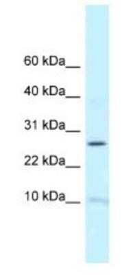 Western Blot RPL39 Antibody