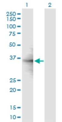 Western Blot: RPL6 Antibody [H00006128-B03P] - Analysis of RPL6 expression in transfected 293T cell line. Lane 1: RPL6 transfected lysate (31.68 KDa). Lane 2: Non-transfected lysate.