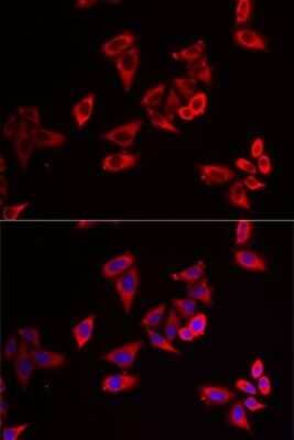 Immunocytochemistry/Immunofluorescence: RPL9 Antibody [NBP2-93947] - Analysis of MCF7 cells using RPL9 . Blue: DAPI for nuclear staining.