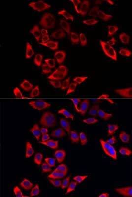 Immunocytochemistry/Immunofluorescence: RPL9 Antibody [NBP2-94567] - Analysis of MCF-7 cells using RPL9 . Blue: DAPI for nuclear staining.