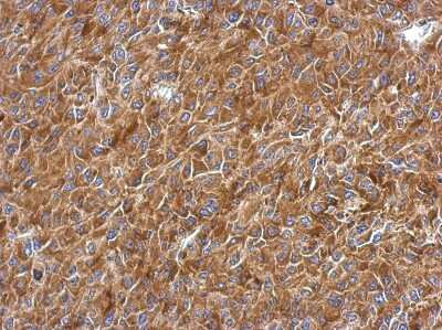 Immunohistochemistry-Paraffin: RPL9 Antibody [NBP2-20219] - Immunohistochemical analysis of paraffin-embedded RT2 xenograft, using antibody at 1:500 dilution.