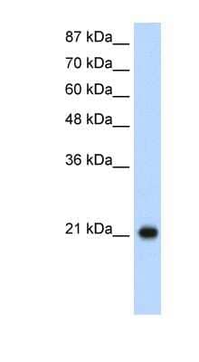 Western Blot: RPL9 Antibody [NBP1-57387] - Jurkat cell lysate, concentration 1.25ug/ml.