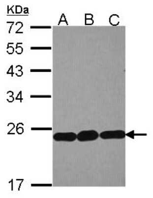 Western Blot: RPL9 Antibody [NBP2-20219] - Sample (30 ug of whole cell lysate) A: Hela B: Hep G2 C: HCT116 12% SDS PAGE gel, diluted at 1:1000.