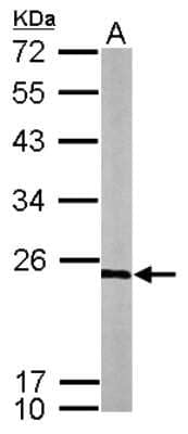 Western Blot: RPL9 Antibody [NBP2-20219] - Sample (50 ug of whole cell lysate) A: Mouse Brain, 12% SDS PAGE gel, diluted at 1:1000.