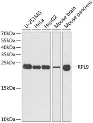 Western Blot: RPL9 Antibody [NBP2-93947] - Analysis of extracts of various cell lines, using RPL9 at 1:1000 dilution. Secondary antibody: HRP Goat Anti-Rabbit IgG (H+L) at 1:10000 dilution. Lysates/proteins: 25ug per lane. Blocking buffer: 3% nonfat dry milk in TBST. Detection: ECL Basic Kit . Exposure time: 90s.