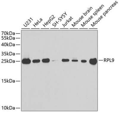 Western Blot: RPL9 Antibody [NBP2-94567] - Analysis of extracts of various cell lines, using RPL9 at 1:1000 dilution. Secondary antibody: HRP Goat Anti-Rabbit IgG (H+L) at 1:10000 dilution. Lysates/proteins: 25ug per lane. Blocking buffer: 3% nonfat dry milk in TBST. Detection: ECL Basic Kit . Exposure time: 90s.