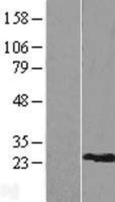 Western Blot: RPL9 Overexpression Lysate (Adult Normal) [NBP2-08643] Left-Empty vector transfected control cell lysate (HEK293 cell lysate); Right -Over-expression Lysate for RPL9.