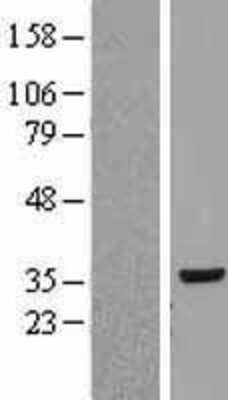 Western Blot: RPLP0 Overexpression Lysate (Adult Normal) [NBP2-08971] Left-Empty vector transfected control cell lysate (HEK293 cell lysate); Right -Over-expression Lysate for RPLP0.