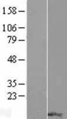 Western Blot: RPP14 Overexpression Lysate (Adult Normal) [NBP2-08328] Left-Empty vector transfected control cell lysate (HEK293 cell lysate); Right -Over-expression Lysate for RPP14.