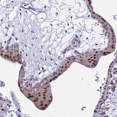 Immunohistochemistry-Paraffin RPP20 Antibody - BSA Free