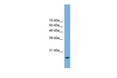 Western Blot: RPP20 Antibody [NBP2-85660] - WB Suggested Anti-POP5 Antibody Titration: 0.2-1 ug/ml. Positive Control: Transfected 293T