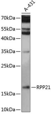 Western Blot: RPP21 Antibody [NBP2-93536] - Analysis of extracts of A431 cells, using RPP21 .Exposure time: 15s.