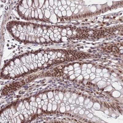 Immunohistochemistry-Paraffin: RPP25 Antibody [NBP1-92349] - Staining of human colon shows moderate nuclear positivity in glandular cells.