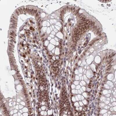 Immunohistochemistry-Paraffin: RPP25 Antibody [NBP1-92349] - Staining of human colon shows moderate nuclear positivity in glandular cells.