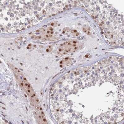 Immunohistochemistry-Paraffin: RPP25 Antibody [NBP1-92349] - Staining of human testis shows moderate nuclear positivity in Leydig cells.