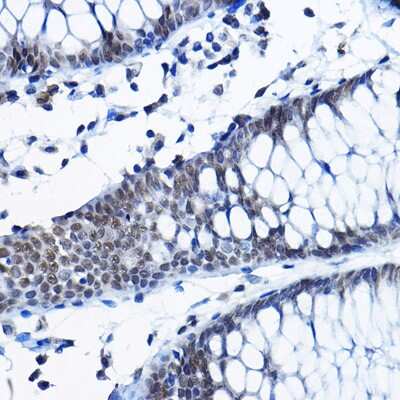 Immunohistochemistry-Paraffin: RPP25 Antibody [NBP2-94328] - Immunohistochemistry of paraffin-embedded human colon using RPP25 Rabbit pAb (NBP2-94328) at dilution of 1:100 (40x lens). Perform high pressure antigen retrieval with 10 mM citrate buffer pH 6.0 before commencing with IHC staining protocol.