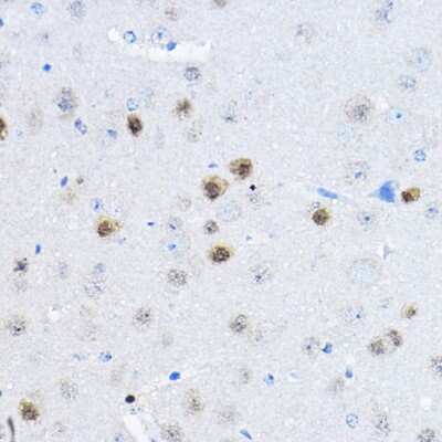 Immunohistochemistry-Paraffin: RPP25 Antibody [NBP2-94328] - Immunohistochemistry of paraffin-embedded mouse brain using RPP25 Rabbit pAb (NBP2-94328) at dilution of 1:100 (40x lens). Perform high pressure antigen retrieval with 10 mM citrate buffer pH 6.0 before commencing with IHC staining protocol.