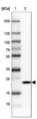 Western Blot: RPP25 Antibody [NBP1-92349] - Lane 1: Marker [kDa] 250, 130, 100, 70, 55, 35, 25, 15, 10Lane 2: Human cell line SK-MEL-30