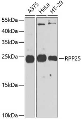 Western Blot: RPP25 Antibody [NBP2-94328] - Analysis of extracts of various cell lines, using RPP25 . Exposure time: 90s.