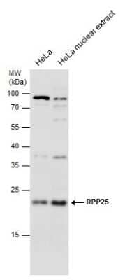 Western Blot: RPP25 Antibody [NBP3-12930] - RPP25 antibody detects RPP25 protein by western blot analysis. HeLa whole cell extracts and nuclear extracts (30 ug) were separated by 12% SDS-PAGE, and the membrane was blotted with RPP25 antibody (NBP3-12930) diluted at 1:1000.