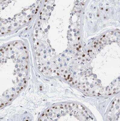 Immunohistochemistry-Paraffin: RPP30 Antibody [NBP1-80658] - Staining of human testis shows moderate nuclear positivity in cells in seminiferous ducts and Leydig cells.