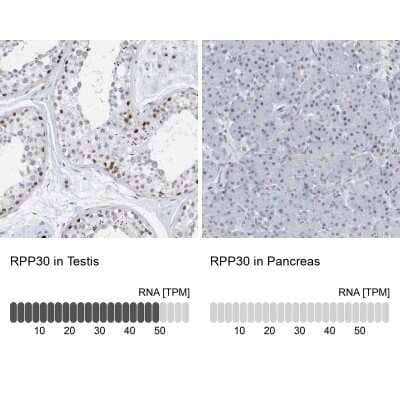 Immunohistochemistry-Paraffin RPP30 Antibody