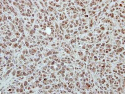 Immunohistochemistry-Paraffin: RPP30 Antibody [NBP2-20221] - Immunohistochemical analysis of paraffin-embedded PC9 xenograft, using antibody at 1:500 dilution.