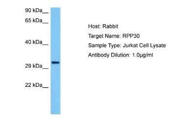 Western Blot: RPP30 Antibody [NBP2-85662] - Host: Rabbit. Target Name: RPP30. Sample Tissue: Human Jurkat Whole Cell lysates. Antibody Dilution: 1ug/ml