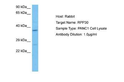 Western Blot: RPP30 Antibody [NBP2-85663] - Host: Rabbit. Target Name: RPP30. Sample Tissue: Human PANC1 Whole Cell lysates. Antibody Dilution: 1ug/ml