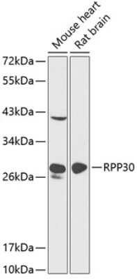 Western Blot: RPP30 Antibody [NBP2-95130] - Analysis of extracts of various cell lines, using RPP30 . Exposure time: 90s.