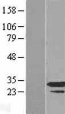 Western Blot: RPP30 Overexpression Lysate (Adult Normal) [NBL1-15554] Left-Empty vector transfected control cell lysate (HEK293 cell lysate); Right -Over-expression Lysate for RPP30.