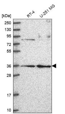 Western Blot RPP38 Antibody