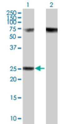 Western Blot: RPP40 Antibody [H00010799-B01P] - Analysis of RPP40 expression in transfected 293T cell line by RPP40 polyclonal antibody.  Lane 1: RPP40 transfected lysate(26.84 KDa). Lane 2: Non-transfected lysate.