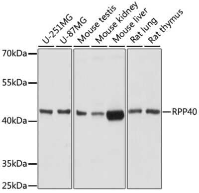 Western Blot: RPP40 Antibody [NBP2-93071] - Analysis of extracts of various cell lines, using RPP40 at 1:1000 dilution. Secondary antibody: HRP Goat Anti-Rabbit IgG (H+L) at 1:10000 dilution. Lysates/proteins: 25ug per lane. Blocking buffer: 3% nonfat dry milk in TBST. Detection: ECL Basic Kit . Exposure time: 10s.